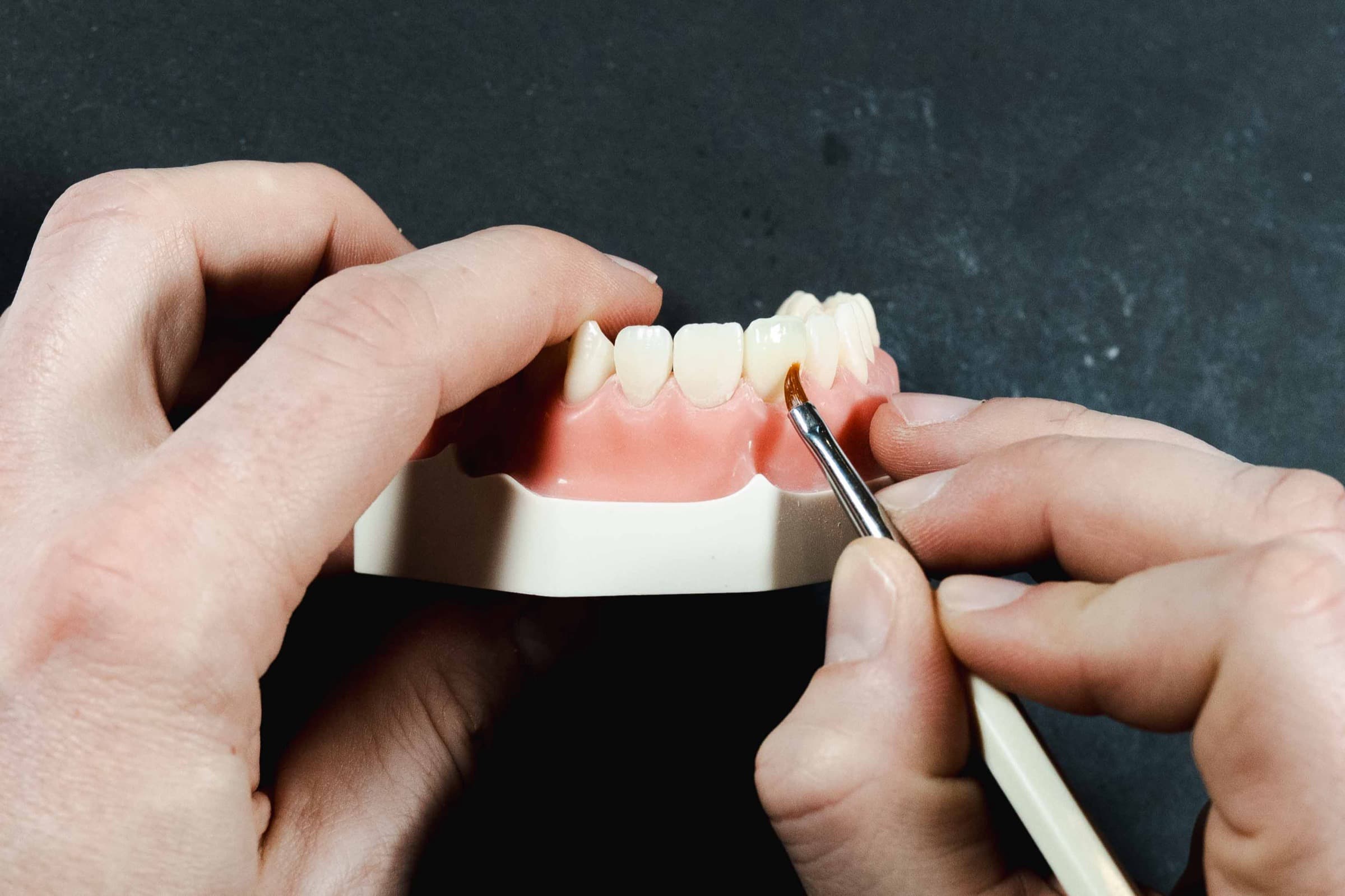 A delegate placing composite on a typodont tooth with a brush at the Simplifi course